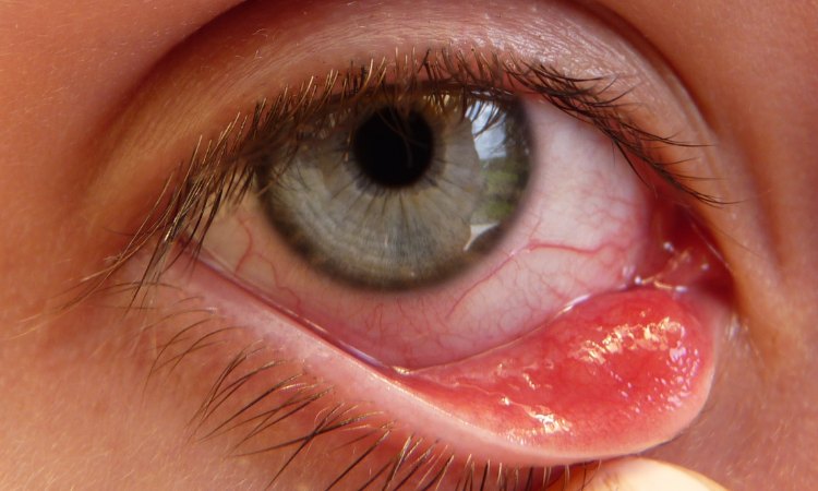 Unutrašnji čmičak